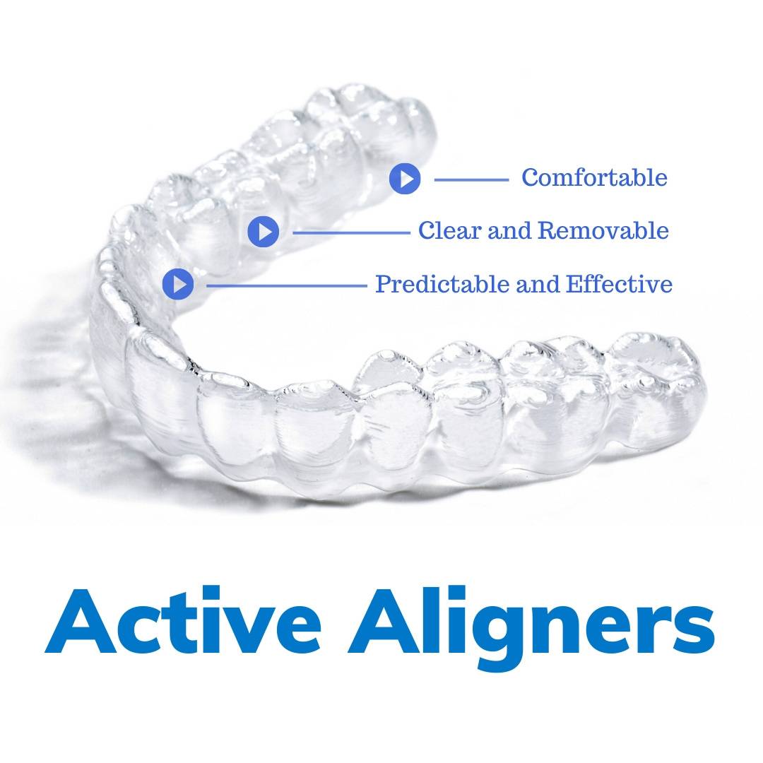 Active Aligners are comfortable, clear, removable, predictable and effective