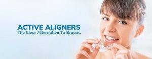 ACTIVE ALIGNERS the clear alternative to braces - clear aligners vs braces