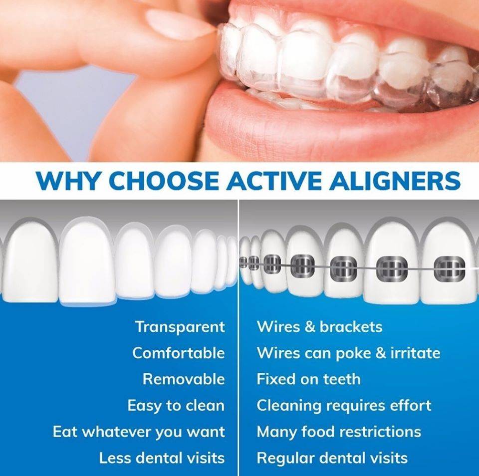 Dr Marc Sher Active Aligners