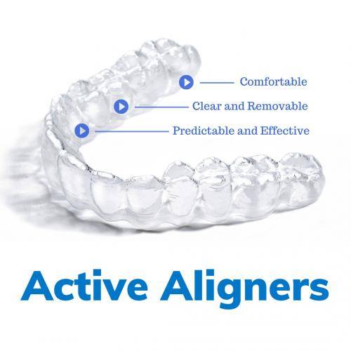 Active Aligners, Comfortable, Clear and removable, predictable and effective