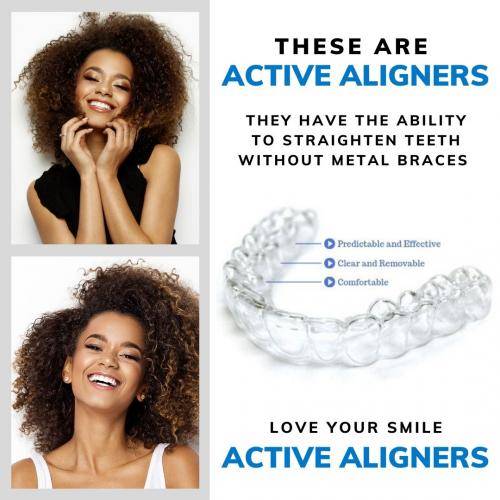 These are as Active Aligners - girl smiling